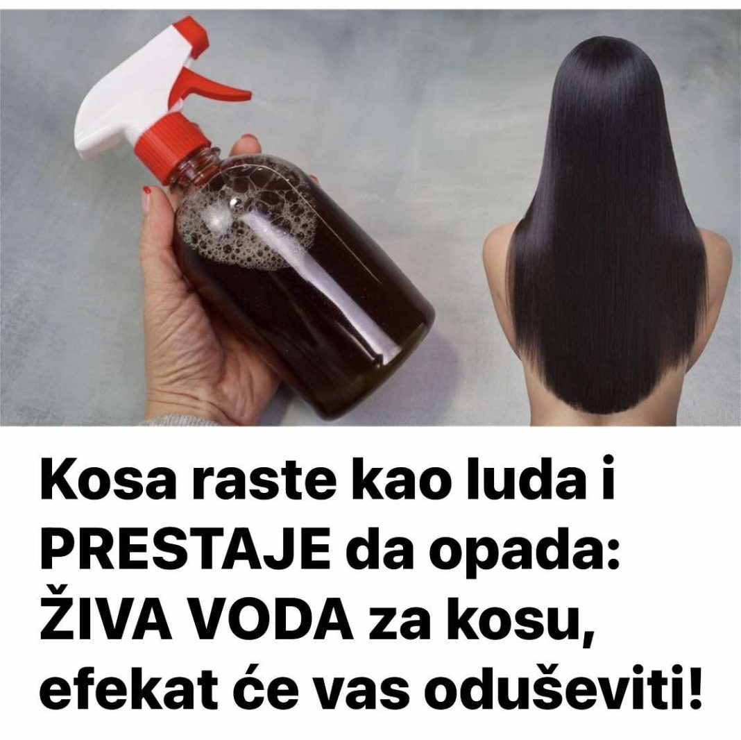 Kosa raste kao luda i PRESTAJE da opada: ŽIVA VODA za kosu, efekat će vas oduševiti! - featured image Kosa raste kao luda i PRESTAJE da opada: ŽIVA VODA za kosu, efekat će vas oduševiti! - featured image