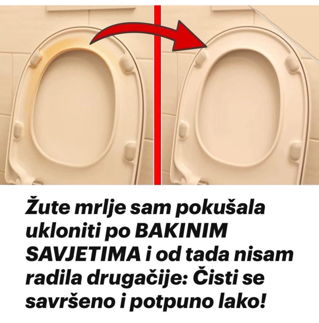 ŽUTE MRLJE SAM UKL0NlLA P0 BAKlNlM SAVJETlMA: Čisti se savršeno i potpuno lako! - featured image ŽUTE MRLJE SAM UKL0NlLA P0 BAKlNlM SAVJETlMA: Čisti se savršeno i potpuno lako! - featured image
