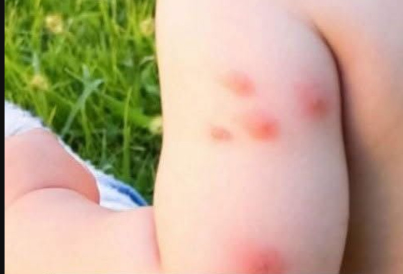 KOMARCI VAM PRAVE PAKAO OD ŽIVOTA? Samo isijecite OVO VOĆE na pola i ostavite u sobi, VIŠE IH NIKADA NEĆETE VIDJETI BLIZU! - featured image