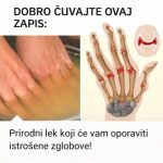 Bolovi u zglobovima ruku i nogu simptomi i lečenje Bolovi u zglobovima ruku i nogu simptomi i lečenje - featured image