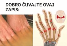 Bolovi u zglobovima ruku i nogu simptomi i lečenje Bolovi u zglobovima ruku i nogu simptomi i lečenje - featured image