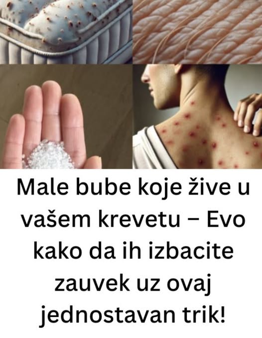 Male bube koje žive u vašem krevetu – Evo kako da ih izbacite zauvek uz ovaj jednostavan trik! - featured image Male bube koje žive u vašem krevetu – Evo kako da ih izbacite zauvek uz ovaj jednostavan trik! - featured image