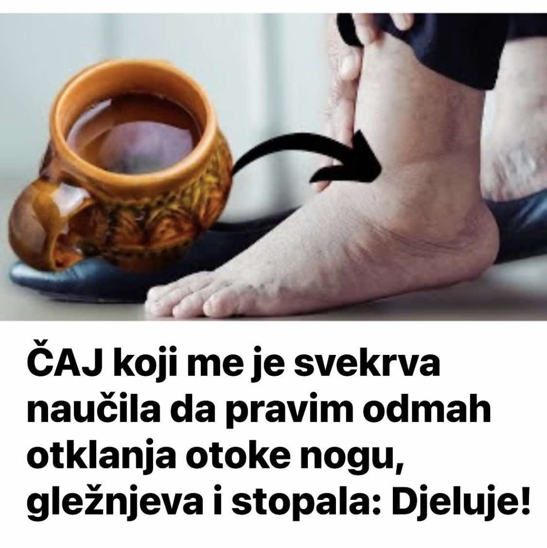 ČAJ koji me je svekrva naučila da pravim odmah otklanja otoke nogu, gležnjeva i stopala: Djeluje! - featured image