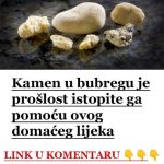 KAMEN U BUBREGU BIT ĆE PROŠLOST..ISTOPITE GA POMOĆU OVOG DOMAĆEG LIJEKA KAMEN U BUBREGU BIT ĆE PROŠLOST..ISTOPITE GA POMOĆU OVOG DOMAĆEG LIJEKA - featured image
