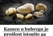KAMEN U BUBREGU BIT ĆE PROŠLOST..ISTOPITE GA POMOĆU OVOG DOMAĆEG LIJEKA KAMEN U BUBREGU BIT ĆE PROŠLOST..ISTOPITE GA POMOĆU OVOG DOMAĆEG LIJEKA - featured image