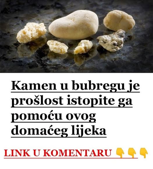 KAMEN U BUBREGU BIT ĆE PROŠLOST..ISTOPITE GA POMOĆU OVOG DOMAĆEG LIJEKA - featured image