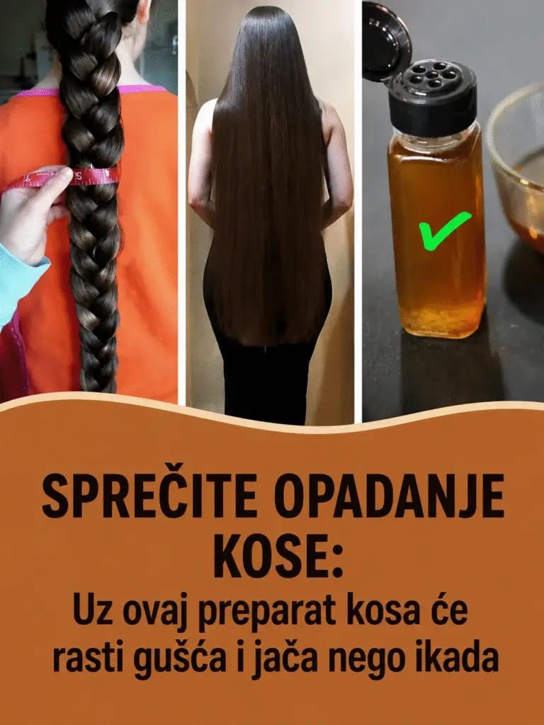 SPREČITE OPADANJE KOSE: Uz ovaj preparat kosa će rasti gušća i jača nego ikada - featured image SPREČITE OPADANJE KOSE: Uz ovaj preparat kosa će rasti gušća i jača nego ikada - featured image