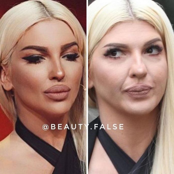 STVARNOST VS INSTAGRAM: Ovako zaista izgledaju pjevačice bez filtera i photoshopa! Ceca je najveće iznenađenje – POGLEDAJTE NJENU NEOBRAĐENU SLIKU (FOTO) - featured image STVARNOST VS INSTAGRAM: Ovako zaista izgledaju pjevačice bez filtera i photoshopa! Ceca je najveće iznenađenje – POGLEDAJTE NJENU NEOBRAĐENU SLIKU (FOTO) - featured image