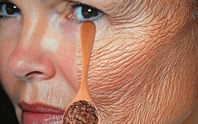 Bez obzira imate li 70 godina, ako ga nanesete na bore, lice će vam biti zategnuto kao staklo. Učinkovitiji je od botoksa. - featured image