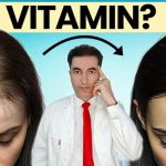 OPASNO: Deficit ovog vitamina UZROKUJE gubitak kose kod žena ! OPASNO: Deficit ovog vitamina UZROKUJE gubitak kose kod žena ! - featured image