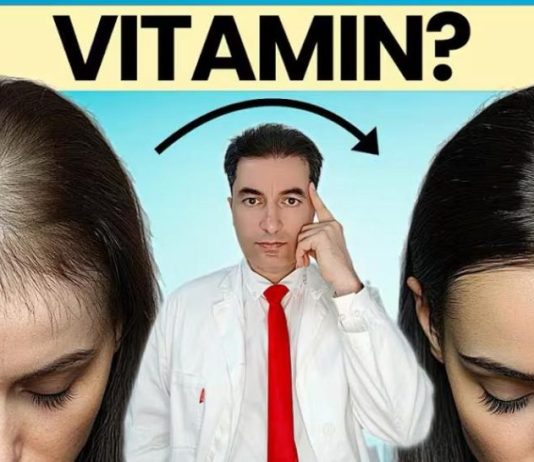 OPASNO: Deficit ovog vitamina UZROKUJE gubitak kose kod žena ! OPASNO: Deficit ovog vitamina UZROKUJE gubitak kose kod žena ! - featured image