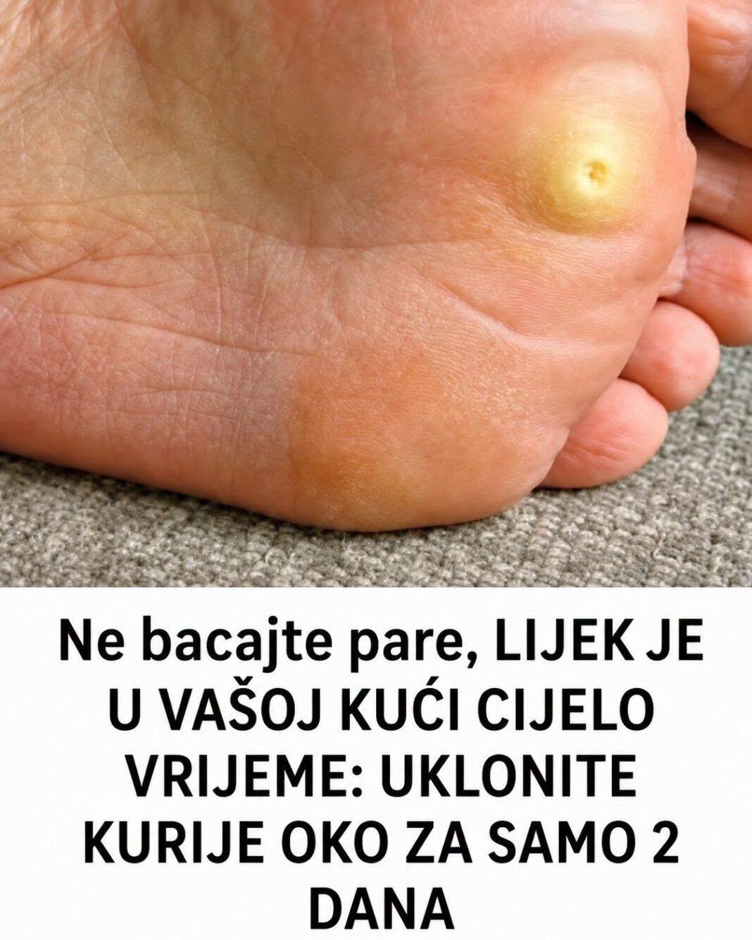 UKLONITE KURIJE OKO ZA SAMO 2 DANA: Ne bacajte pare, LIJEK JE U VAŠOJ KUĆI CIJELO VRIJEME - featured image