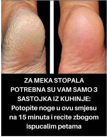 LJEKOVITA MjEŠAVINA ZA SAVRŠENA STOPALA: Pedikir u KUĆNIM USLOVIMA za koji su vam potrebna samo 2 SASTOJKA! - featured image