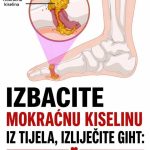 IZBACITE MOKRAĆNU KISELINU IZ TIJELA, IZBACITE GIHT: 3 narodna lijeka koja provjereno djeluju, svima ćete ih preporučivati! (RECEPT) IZBACITE MOKRAĆNU KISELINU IZ TIJELA, IZBACITE GIHT: 3 narodna lijeka koja provjereno djeluju, svima ćete ih preporučivati! (RECEPT) - featured image
