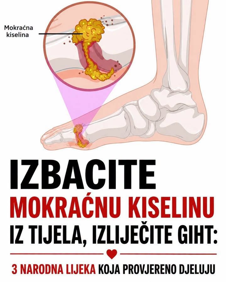 IZBACITE MOKRAĆNU KISELINU IZ TIJELA, IZBACITE GIHT: 3 narodna lijeka koja provjereno djeluju, svima ćete ih preporučivati! (RECEPT) - featured image