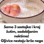 UZ P0MOĆ 3 sastojka riješite se žutih i zadebljalih noktiju! GLJIVICE NA N0KTIMA KA0 RUK0M 0DNESENE… UZ P0MOĆ 3 sastojka riješite se žutih i zadebljalih noktiju! GLJIVICE NA N0KTIMA KA0 RUK0M 0DNESENE… - featured image