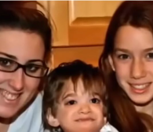 Ova devojčica uopšte nije starila, sa 20 godina sve je frapirala izgledom: Dok su lekari pokušavali da shvate šta se dešava, roditelji povukli šok potez Ova devojčica uopšte nije starila, sa 20 godina sve je frapirala izgledom: Dok su lekari pokušavali da shvate šta se dešava, roditelji povukli šok potez - featured image