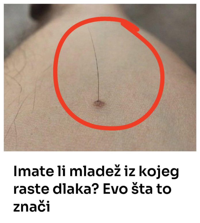 Evo šta tačno znači kada vam iz mladeža raste dlaka: Da li je to opasno, iznenadit ćete se - featured image