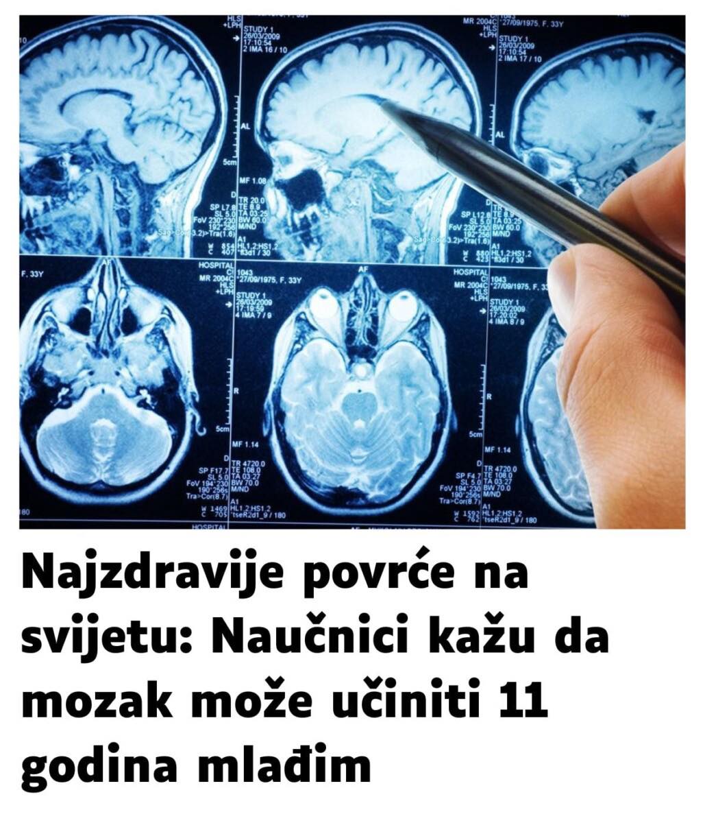 POVRĆE JE TOLIKO ZDRAVO DA O NJEMU PIŠE NJUJORK TAJMS: Amerikanci daju po 30 dolara za jedan list, a ono raste kod nas - featured image