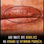 Bele fleke na usnama ili intimnom području? Ne ignorišite ove znake upozorenja! Bele fleke na usnama ili intimnom području? Ne ignorišite ove znake upozorenja! - featured image