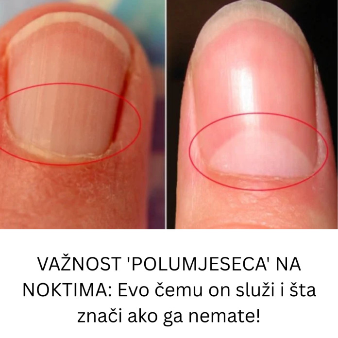 VAŽNOST ‘POLUMJESECA’ NA NOKTIMA: Evo čemu on služi i šta znači ako ga nemate! - featured image VAŽNOST ‘POLUMJESECA’ NA NOKTIMA: Evo čemu on služi i šta znači ako ga nemate! - featured image