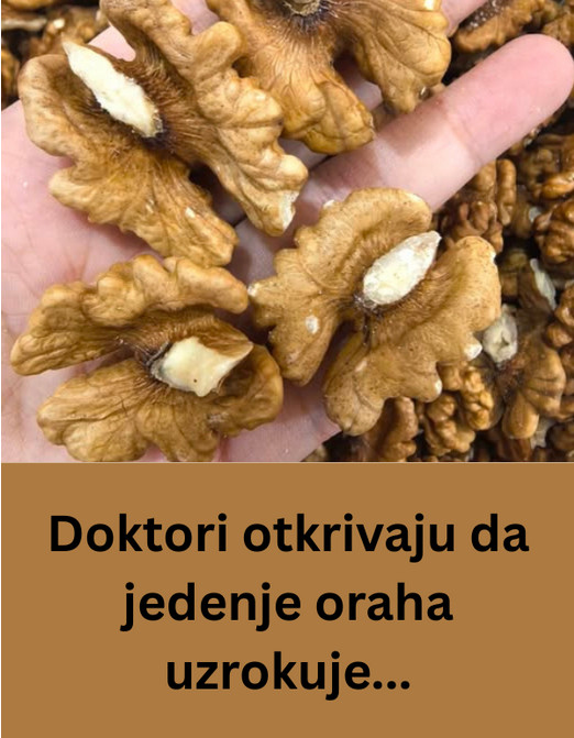Doktori otkrivaju da jedenje oraha uzrokuje… - featured image