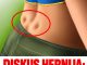 DISKUS HERNIJA: Ovaj DOMAĆI LIJEK potpuno OBNAVLJA KIČMU, JAČA JE I LIJEČI DISKUS HERNIJA: Ovaj DOMAĆI LIJEK potpuno OBNAVLJA KIČMU, JAČA JE I LIJEČI - featured image